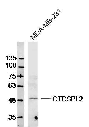CTDSPL2蛋白抗体