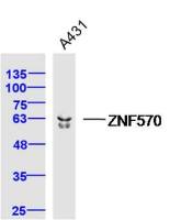 ZNF570锌指蛋白570抗体