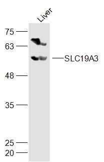 SLC19A3溶质载体家族19成员3抗体