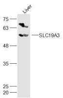 SLC19A3溶质载体家族19成员3抗体