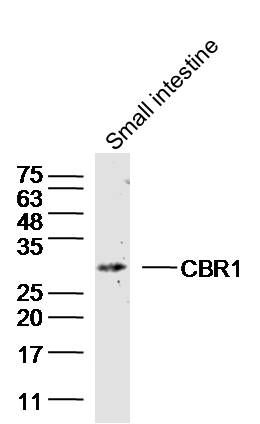 CBR1羰基还原酶1抗体
