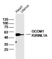 GCOM1/GRINL1A蛋白抗体