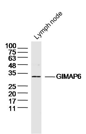 GIMAP6 GTP酶IMAP家族成员6抗体