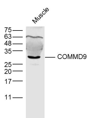COMMD9铜代谢结构域蛋白9抗体 
