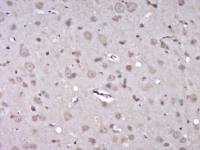 phospho-ZIP Kinase (Thr265)磷酸化死亡相关蛋白激酶3抗体