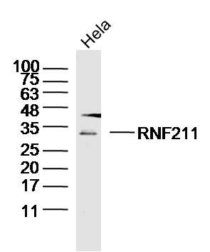 RNF211环指蛋白211抗体