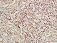 KIF11驱动蛋白样蛋白1抗体(甲状腺激素受体相互作用蛋白5)