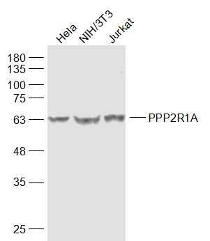 PPP2R1A蛋白质磷酸酶2调节亚基1A抗体