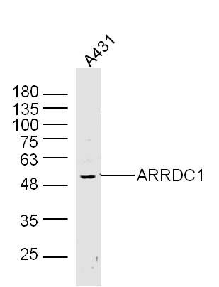 ARRDC1抑制蛋白结构域蛋白1抗体