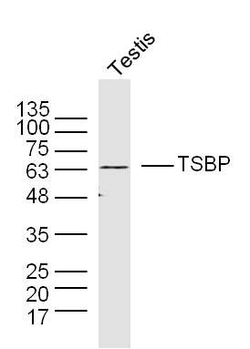 TSBP睾丸特异蛋白抗体