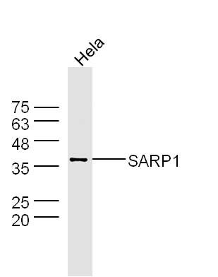 SARP1分泌细胞凋亡相关蛋白1抗体