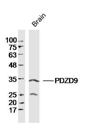 PDZD9 PDZ结构域PDZK9蛋白抗体