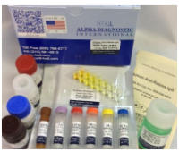 Human Anti-Rabies Virus IgG ELISA (人狂犬病IgG ELISA试剂盒)