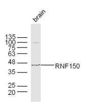 RNF150环指蛋白150抗体