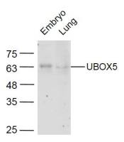 UBOX5泛素结合酶7相互作用蛋白5抗体