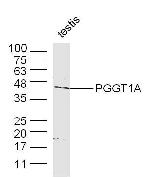 PGGT1A蛋白香叶烯基转移酶1α抗体