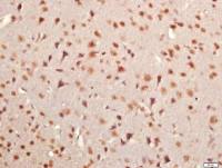 KRCC1含赖氨酸卷曲螺旋蛋白1抗体