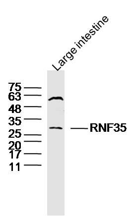 RNF35环指蛋白35抗体