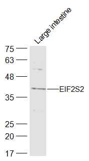 EIF2S2真核启动因子2β抗体