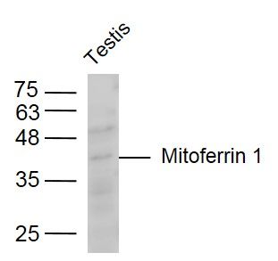 Mitoferrin 1线粒体铁转运蛋白1抗体
