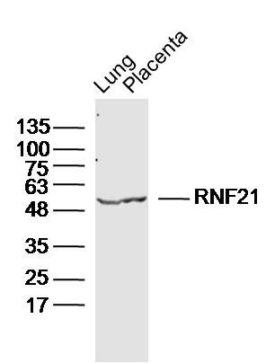 RNF21环指蛋白21抗体