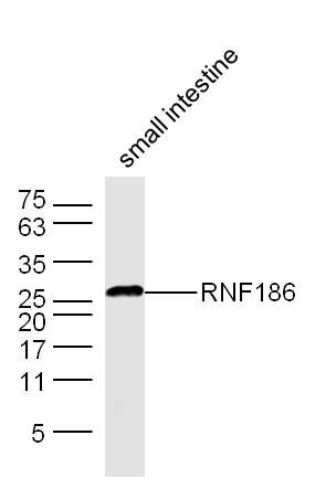 RNF186环指蛋白186抗体