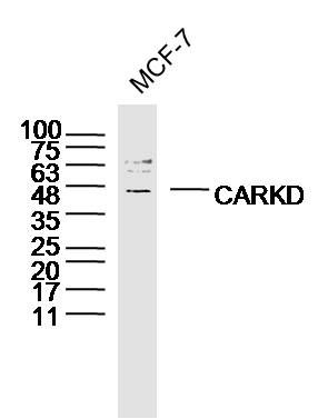 CARKD碳水化合物激酶结构域蛋白质抗体