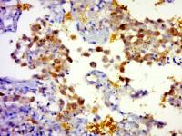 KLHL36 Kelch样蛋白36抗体