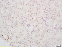 PINX-1端粒酶抑制因子PinX-1抗体