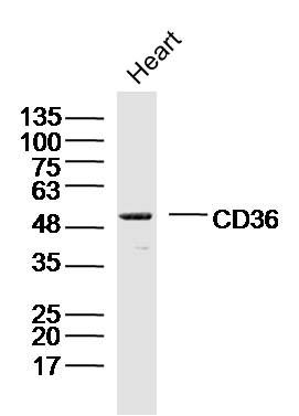 CD36抗体