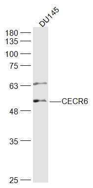 CECR6猫眼综合征染色体候选基因6抗体