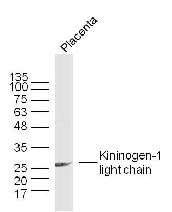 Kininogen-1 light chain高分子量激肽原轻链抗体