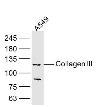 Collagen III型胶原单克隆抗体 