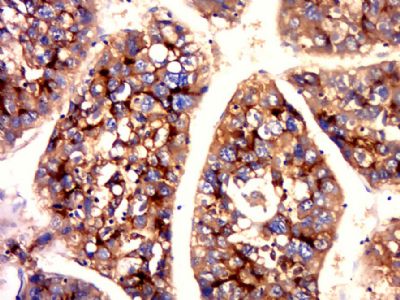 CEA(B5)癌胚抗原单克隆抗体（检测）