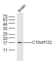 C10orf132 10号染色体开放阅读框132抗体