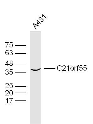 C21orf55 21号染色体开放阅读框55抗体