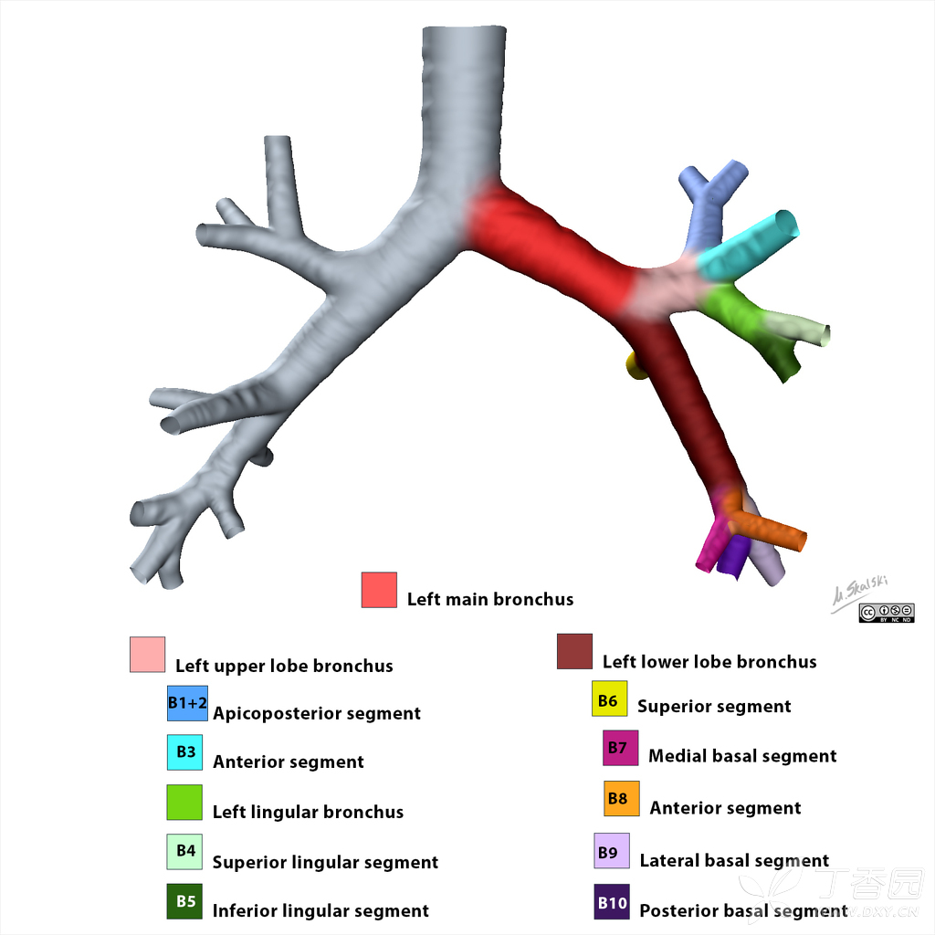 支气管树(左肺)3d模式图