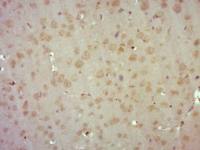 Phospho-Smad3 (Ser425)磷酸化细胞信号转导分子SMAD3单克隆抗体