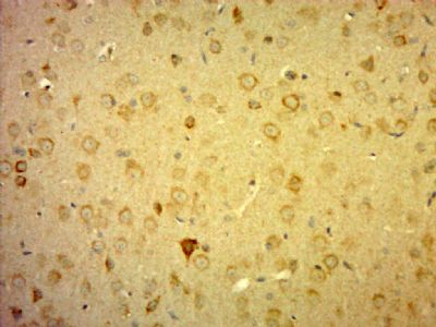 C10orf27第10号染色体开放阅读框27抗体