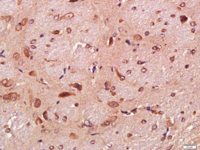 Tau微管相关蛋白单克隆抗体