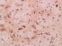 Tau微管相关蛋白单克隆抗体