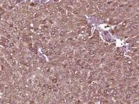 TTR/Prealbumin转甲状腺素蛋白/前白蛋白单克隆抗体