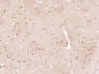 Ubiquitin泛素蛋白单克隆抗体