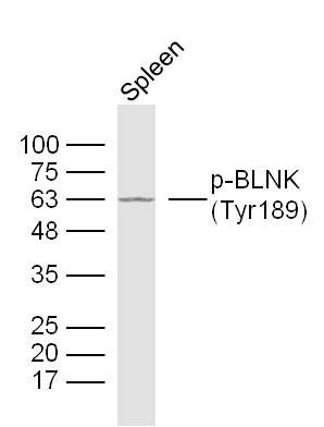 Phospho-BLNK(Tyr189)磷酸化T淋巴细胞连接蛋白抗体