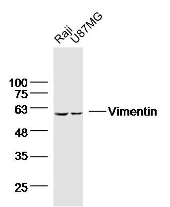 Vimentin波形蛋白单克隆抗体