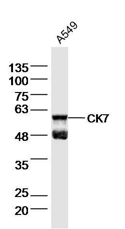 CK7细胞角蛋白7单克隆抗体