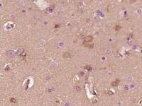 Cystatin C胱抑素C/半胱氨酸蛋白酶抑制剂C单克隆抗体