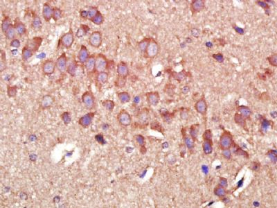 MMP2基质金属蛋白酶2单克隆抗体