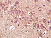 MMP2基质金属蛋白酶2单克隆抗体