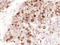 PCNA增殖细胞核抗原单克隆抗体